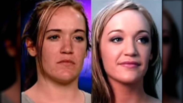 A before and after of a contestant on "The Swan"