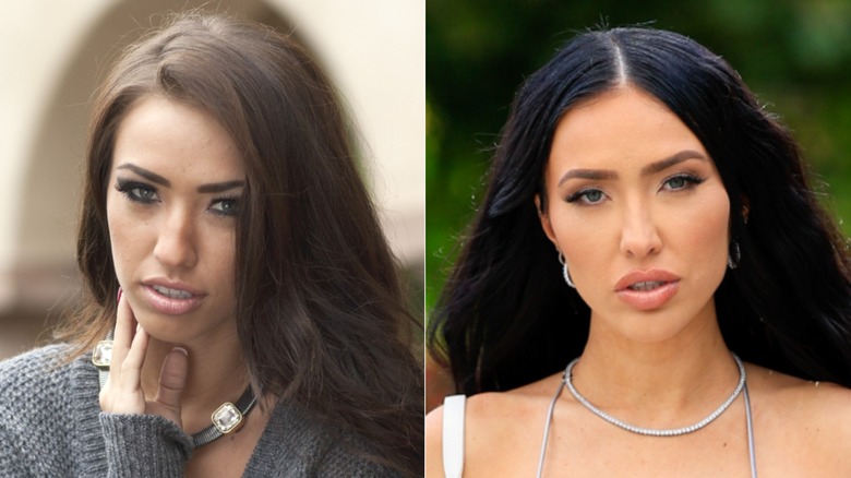 Bre Tiesi before and after surgery