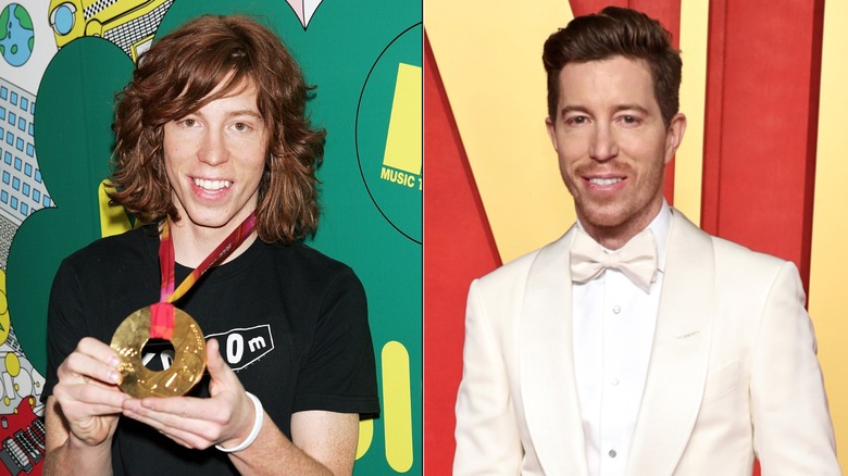 Shaun White with long hair, short hair