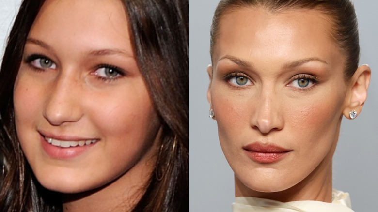 Bella Hadid before and after nose job