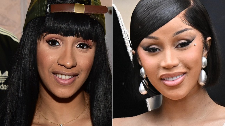 Cardi B before and after nose job