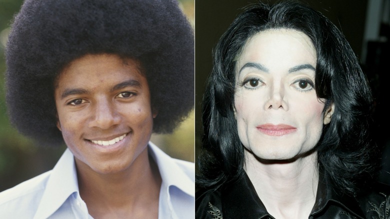 Michael Jackson at 18 and later in the 2000s