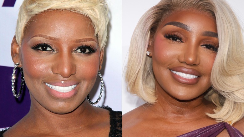 Nene Leakes before and after second nose job