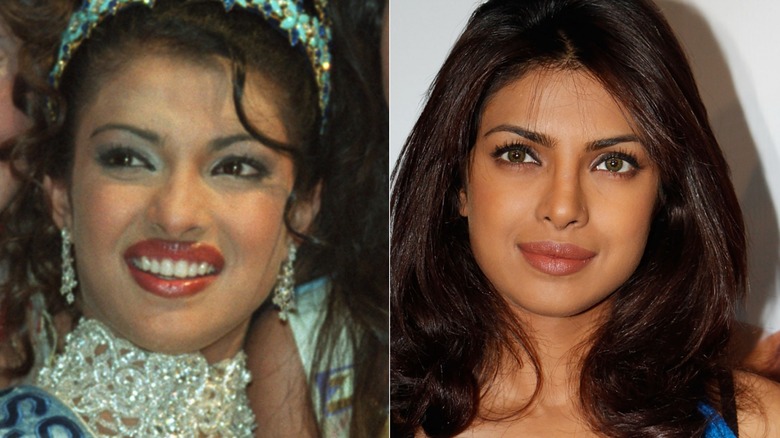 Priyanka Chopra before and after nose job