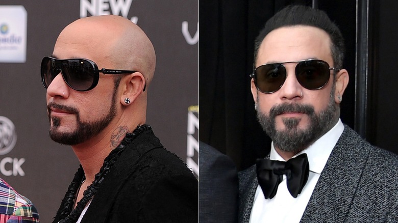 BSB alum AJ McLean before and after hair transplants
