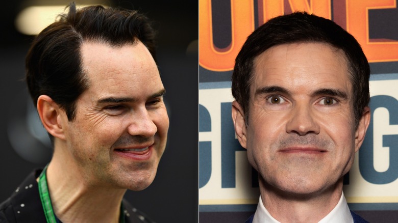 Comedian Jimmy Carr pre- and post-hair transplant