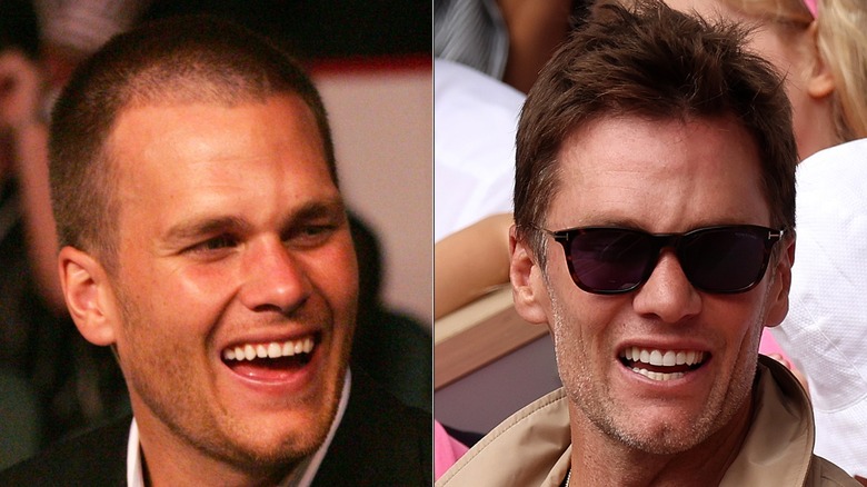 NFL legend Tom Brady