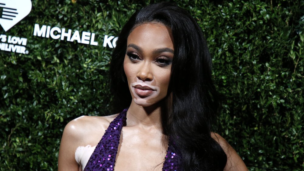Winnie Harlow
