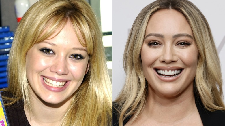 Hillary Duff's teeth before and after split image