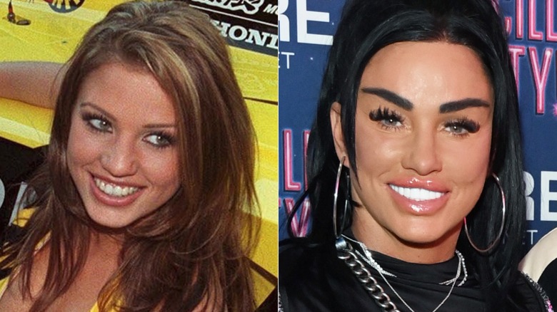 Katie Price's teeth before and after split image