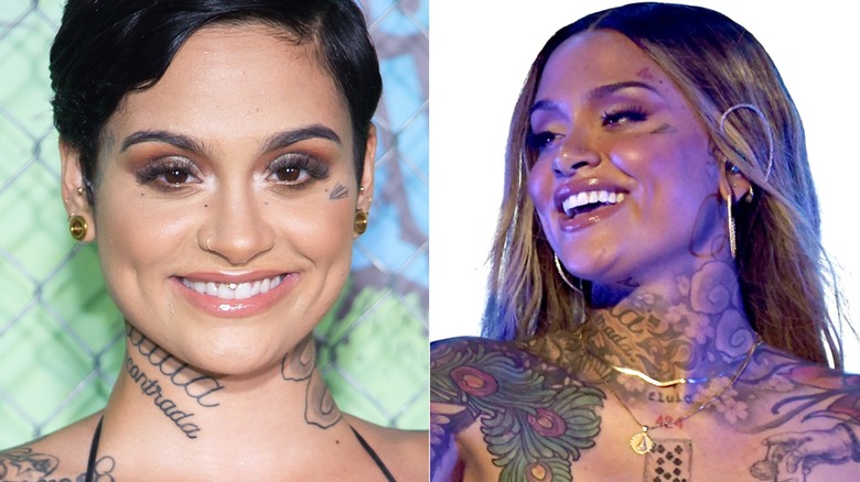 Kehlani's teeth before and after split image