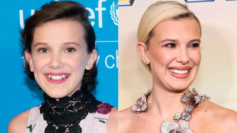 Millie Bobby Brown's teeth before and after split image