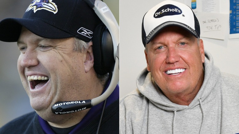 Rex Ryan's teeth before and after split image