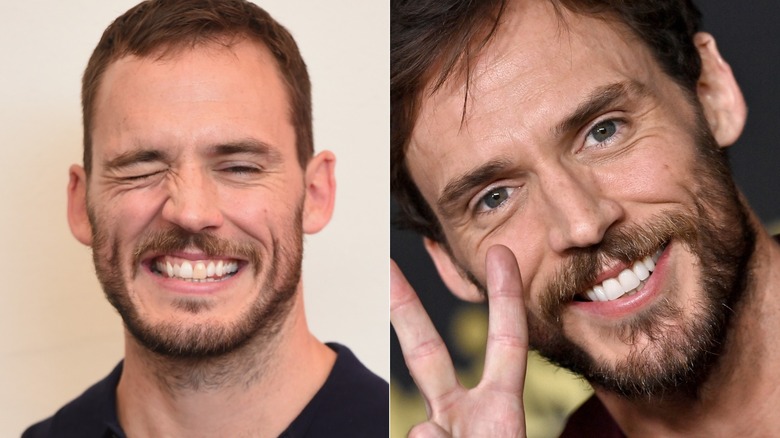 Sam Claflin's teeth before and after split image