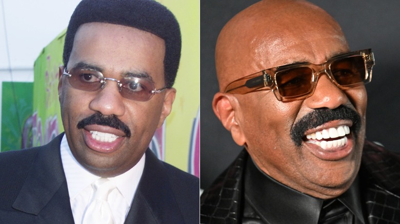Steve Harvey's teeth before and after split image