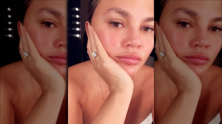 Chrissy Teigen with hand on her face