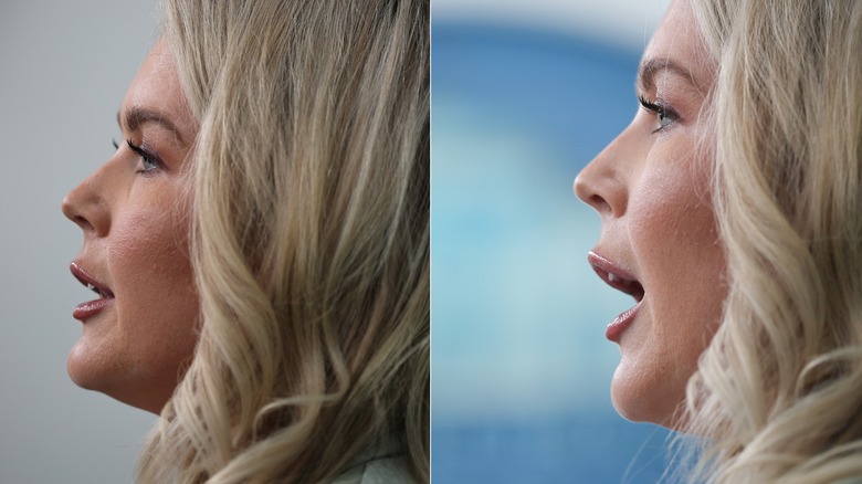 Karoline Leavitt's side profile while speaking at a White House presser