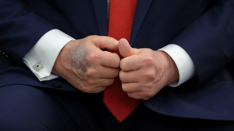 Donald Trump's hands closeup