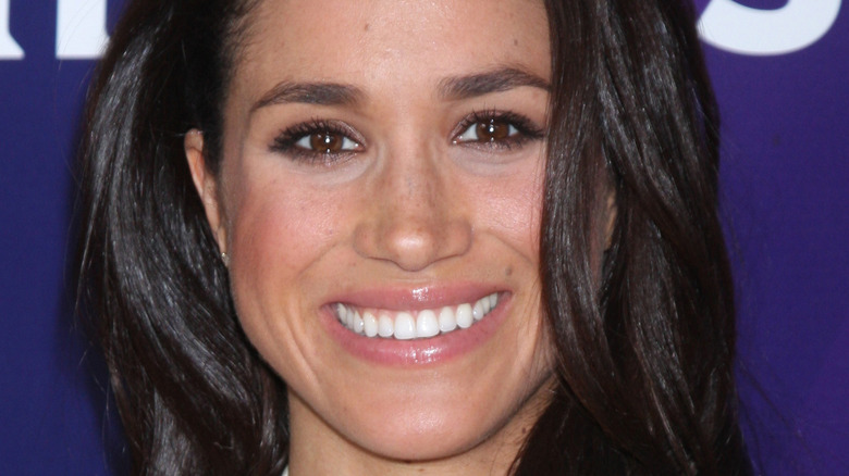 Meghan Markle teeth