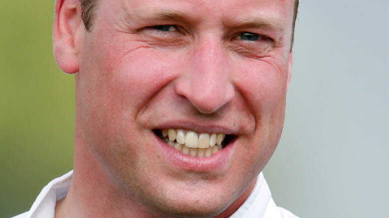 Prince William teeth