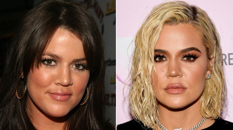 Khloe Kardashian 