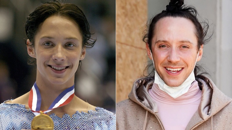 Johnny Weir flashing his medal with a parted hairstyle in one picture, and looking cheerful in a mask and a man bun in the other