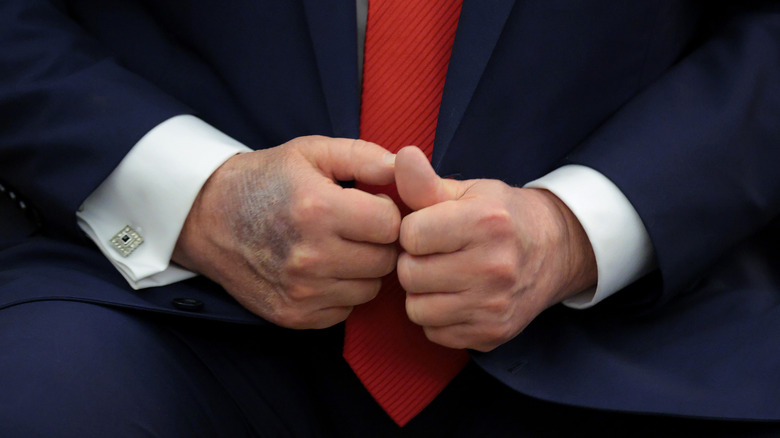 Close up of Donald Trump's hands in August 2025