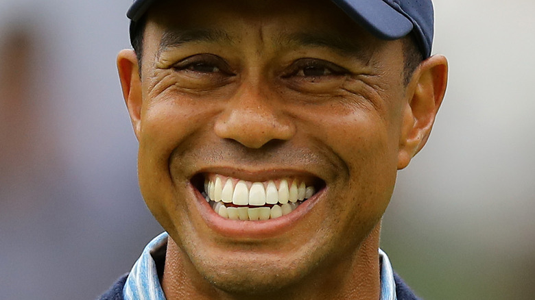 Tiger Woods teeth