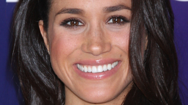 Meghan Markle teeth