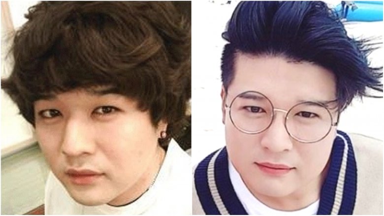 Shindong from Super Junior before-and-after plastic surgery photos