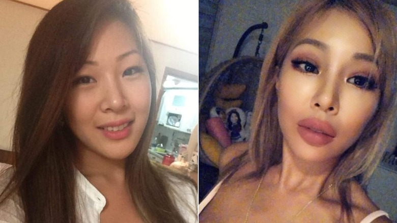 Jessi before-and-after plastic surgery photos