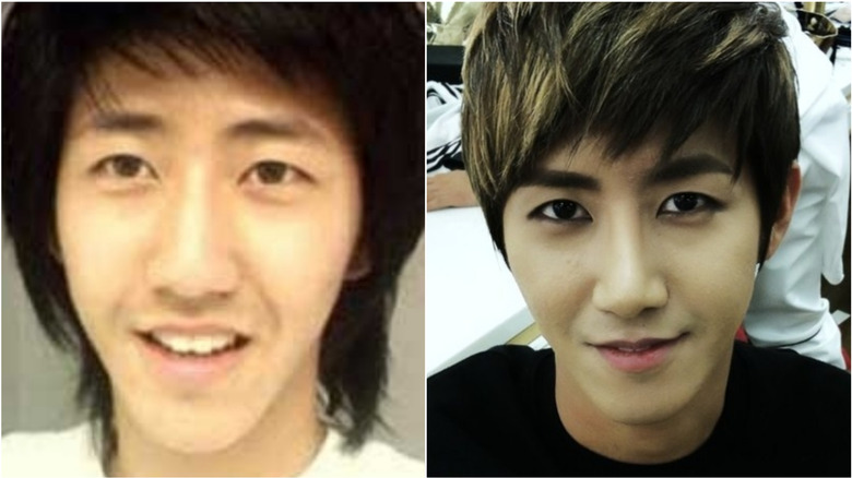 Kwanghee from ZE:A before-and-after plastic surgery photos