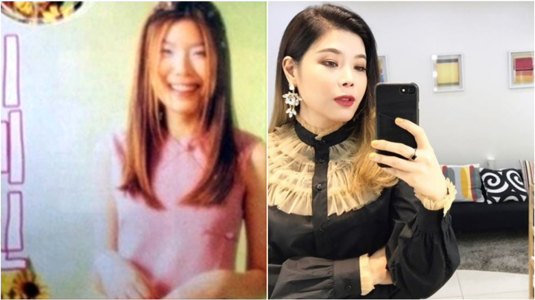 Lyn before-and-after plastic surgery photos