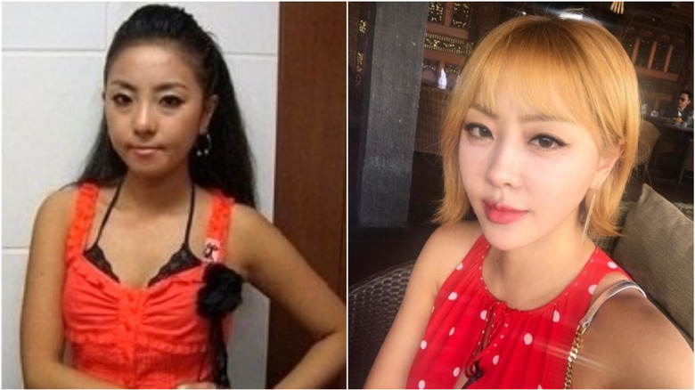 Narsha from Brown Eyed Girls before-and-after plastic surgery photos