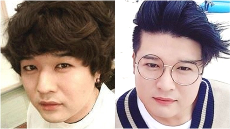 Shindong from Super Junior before-and-after plastic surgery photos