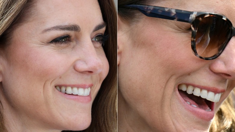 Kate Middleton smiling with food in teeth