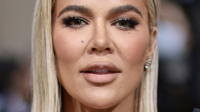 Khloe Kardashian mole