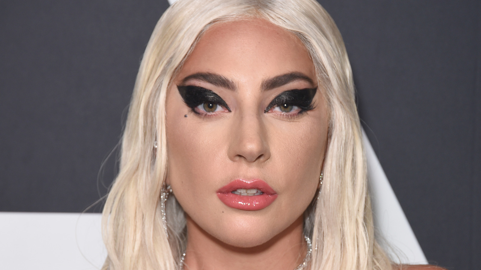 Lady Gaga's Dog Walker Opens Up About His Current Condition