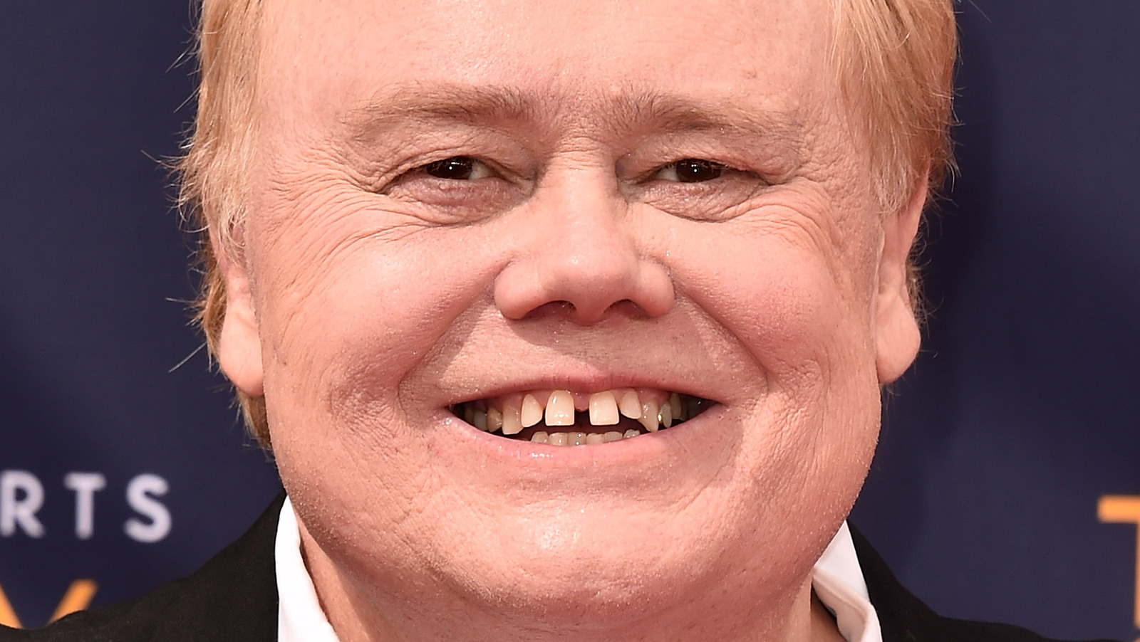 Louie anderson comedian wiki