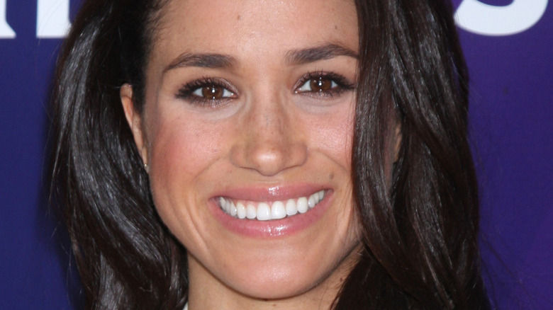 Meghan Markle teeth