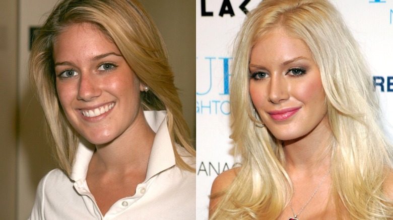 Split image of Heidi Montag smiling in a white polo shirt and smiling in red in 2010