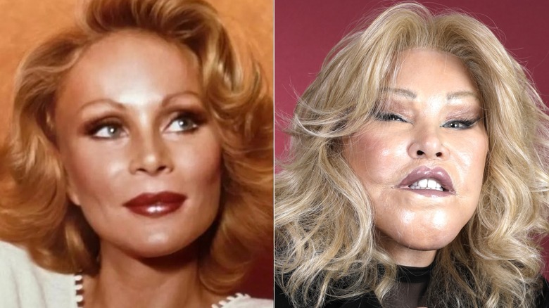 SPlit image of Jocelyn Wildenstein before plastic surgery and posing for a portrait in 2024