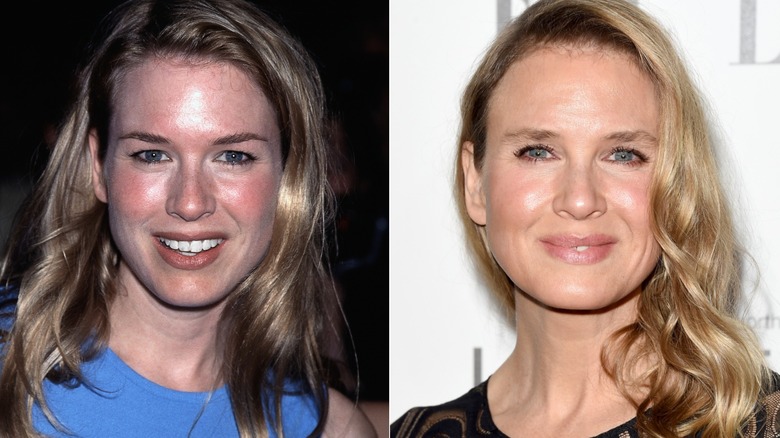 Split image of Renée Zellweger smiling in 1998 and smiling in 2014