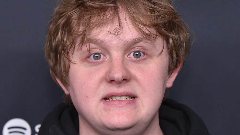 Lewis Capaldi grimacing