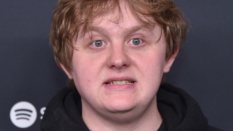 Lewis Capaldi grimacing