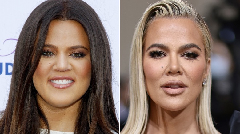 Khloe shop plastic surgery