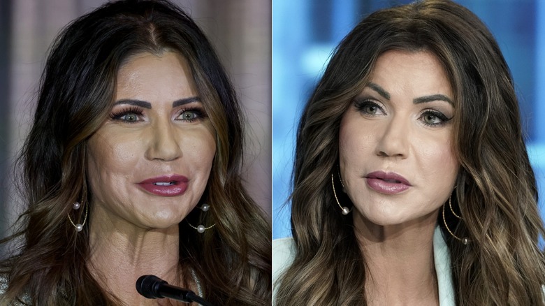Kristi Noem smiling at a podium in 2023 & Kristi Noem speaking in 2024, post-rumored face and neck lift