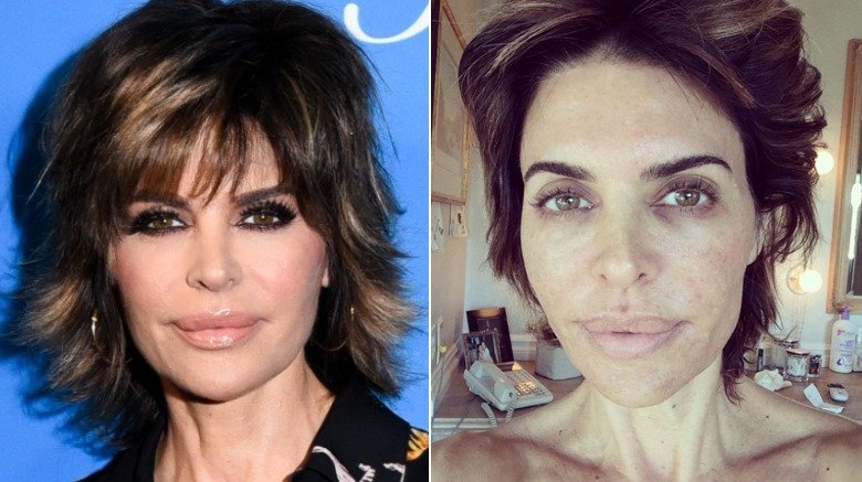 Lisa Rinna