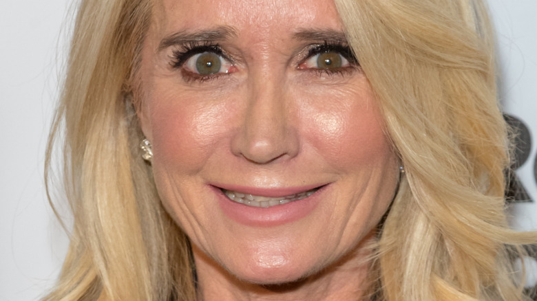 Kim Richards smiling nervously