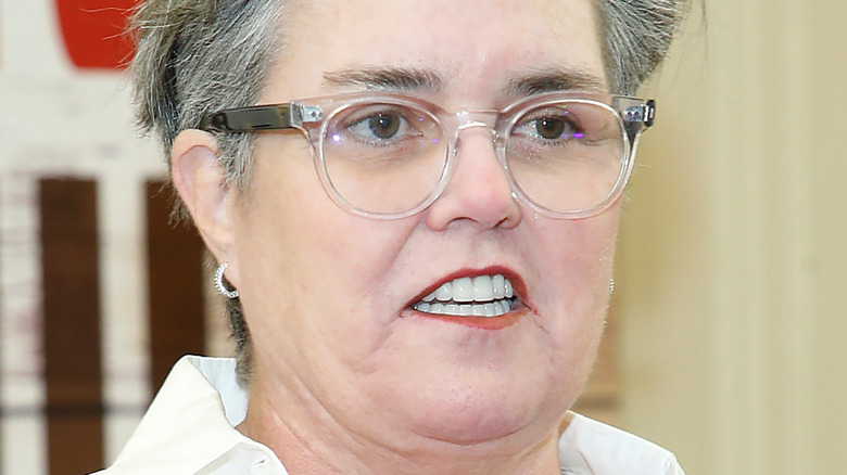 Rosie O'Donnell teeth